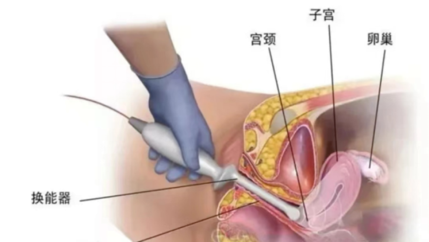 澳门开奖网站,王者杨戬变异,广泛的解释落实支持计划_标清版V4.10
